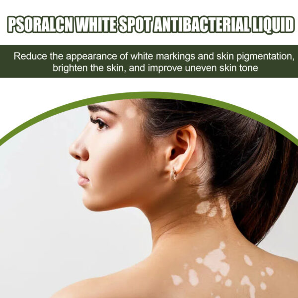 Whitening Skin Moisturizing Care Solution - Image 5