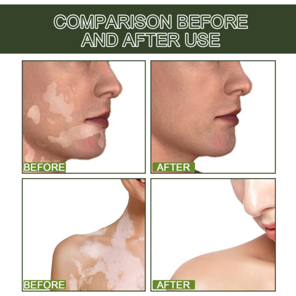 Whitening Skin Moisturizing Care Solution - Image 6