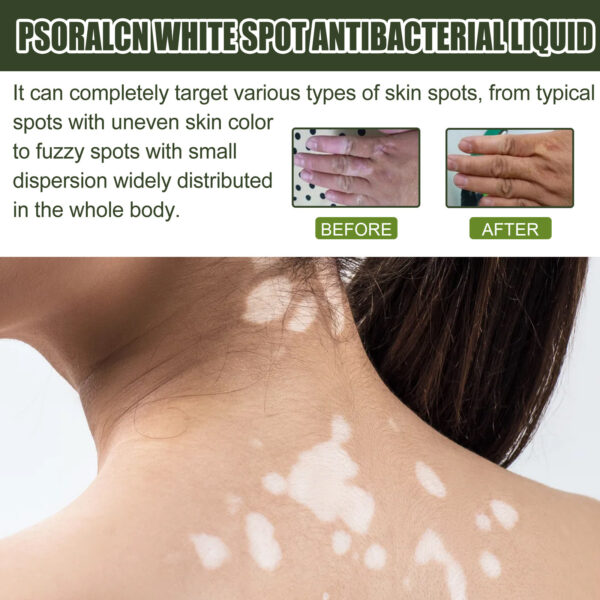 Whitening Skin Moisturizing Care Solution - Image 2